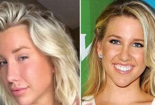 Latest News Savannah Chrisley Plastic Surgery